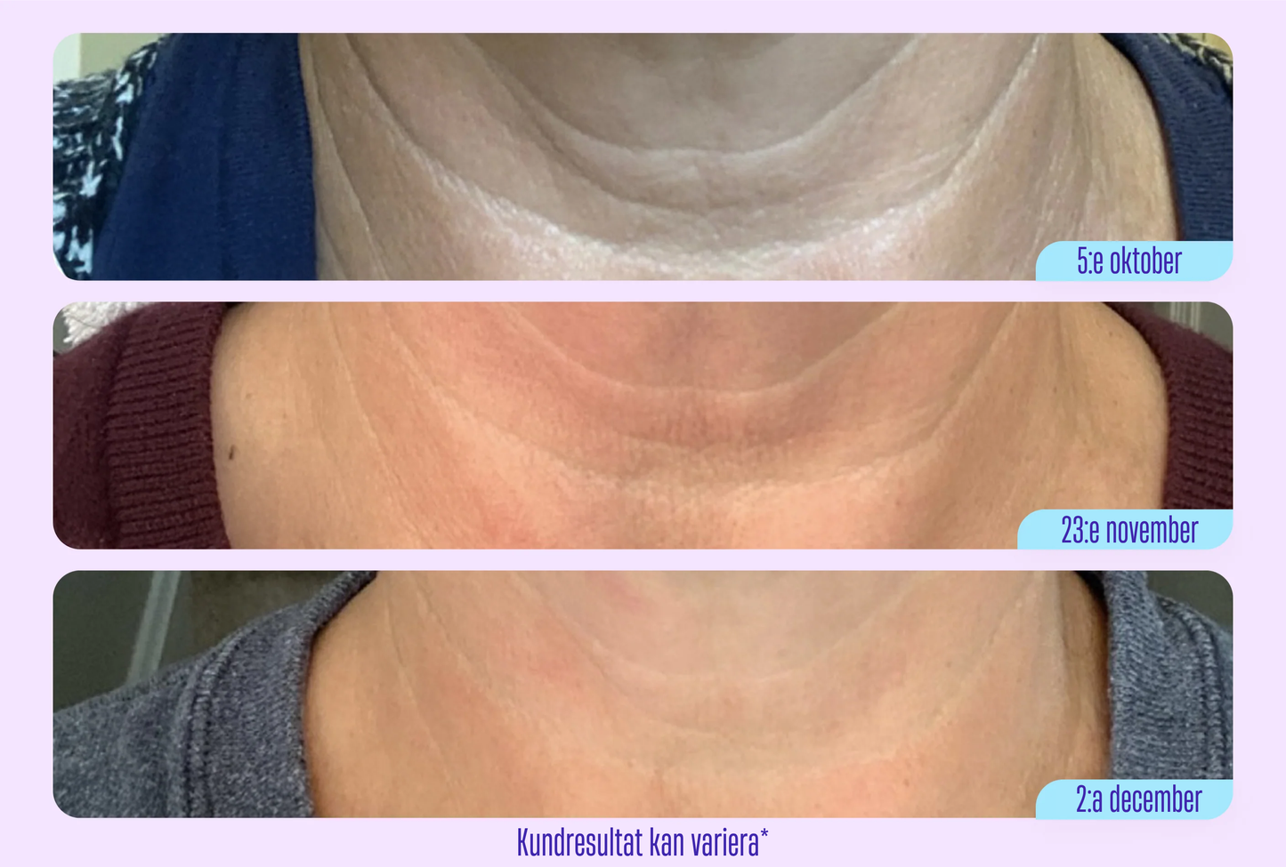 GoPure™ - Inga mer rynkor på halsen