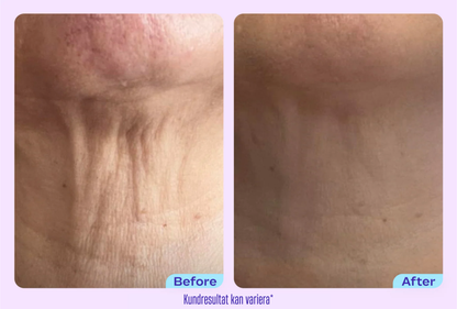 GoPure™ - Inga mer rynkor på halsen